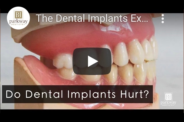 Video About: Do Dental Implants Hurt?