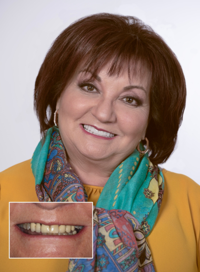 before-after-cosmetic-dentistry-00