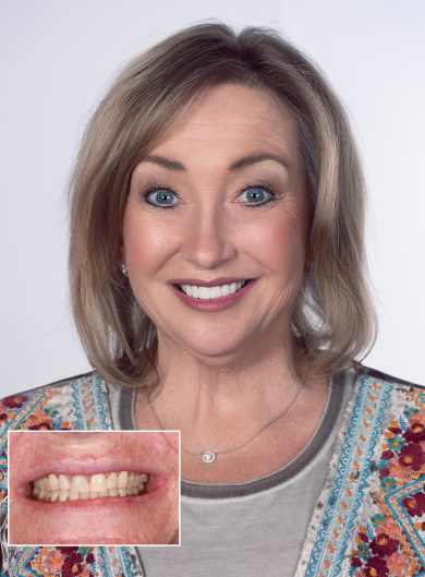 before-after-cosmetic-dentistry-04