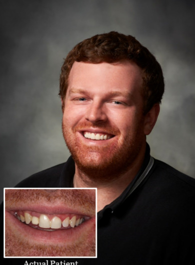 before-after-dental-braces-02