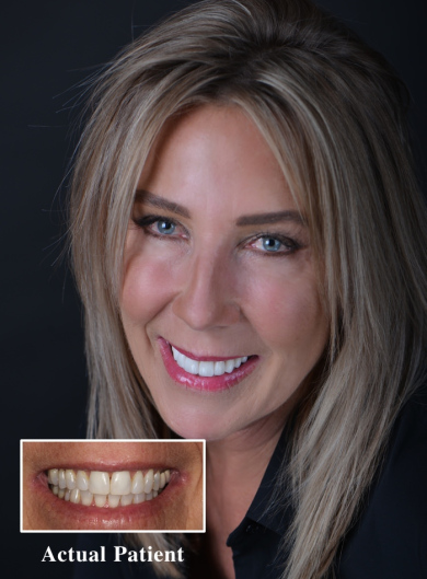 Before after dental braces dentistry photo