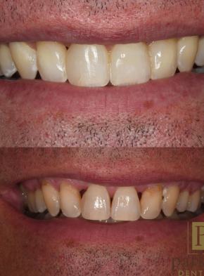 before-after-oral-restoration-09