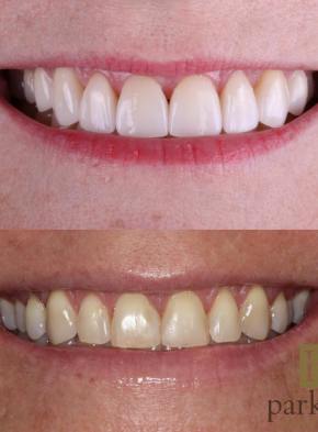 cosmetic-dental-makeover