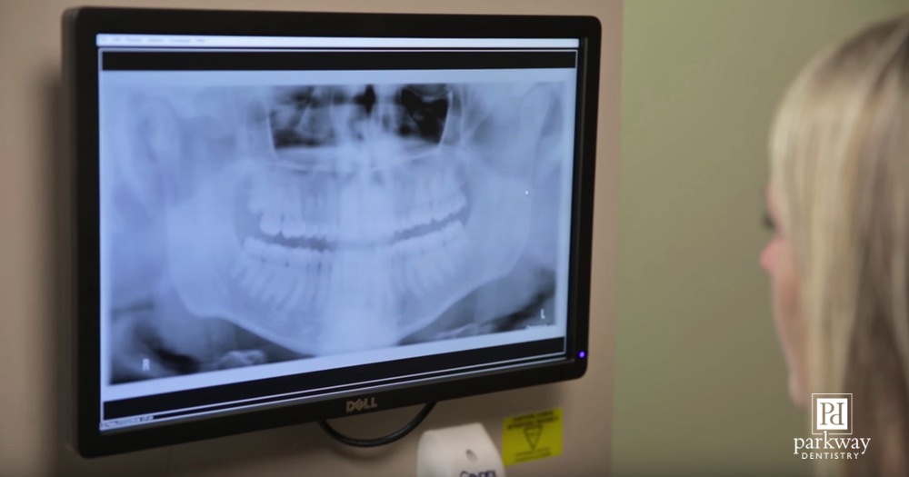 Examining TMJ x-ray at dental office