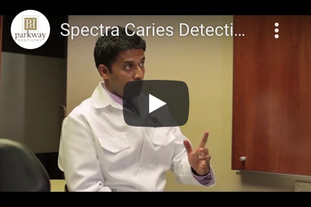 Video About: Caries Detection