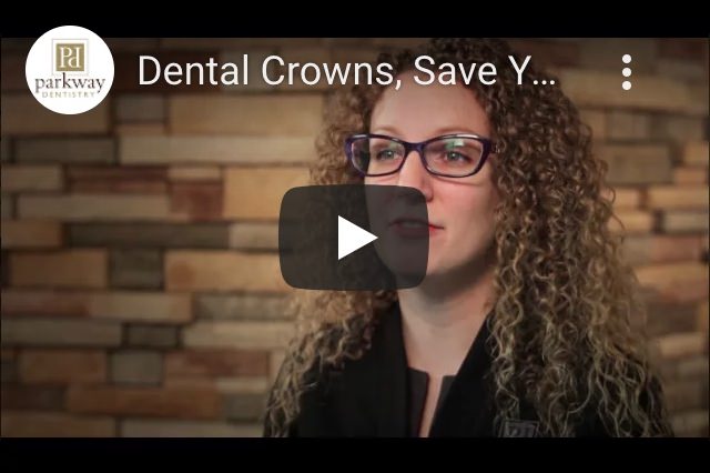 Video About: Dental Crowns