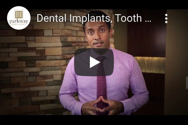 Video About: Dental Implants