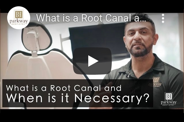 Video About: What is a Root Canal