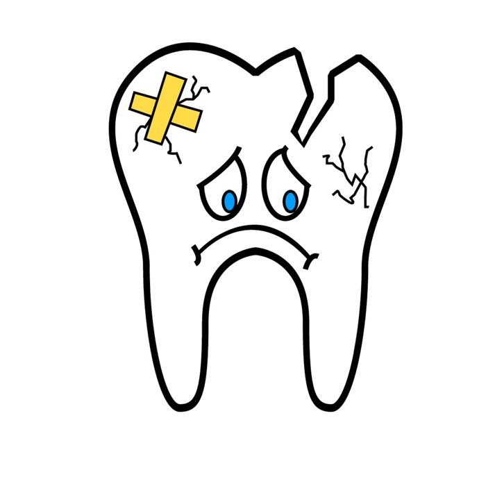 Example of tooth decay