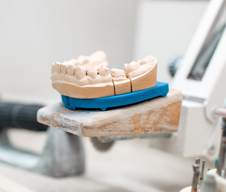 Occlusal Bite Adjustment