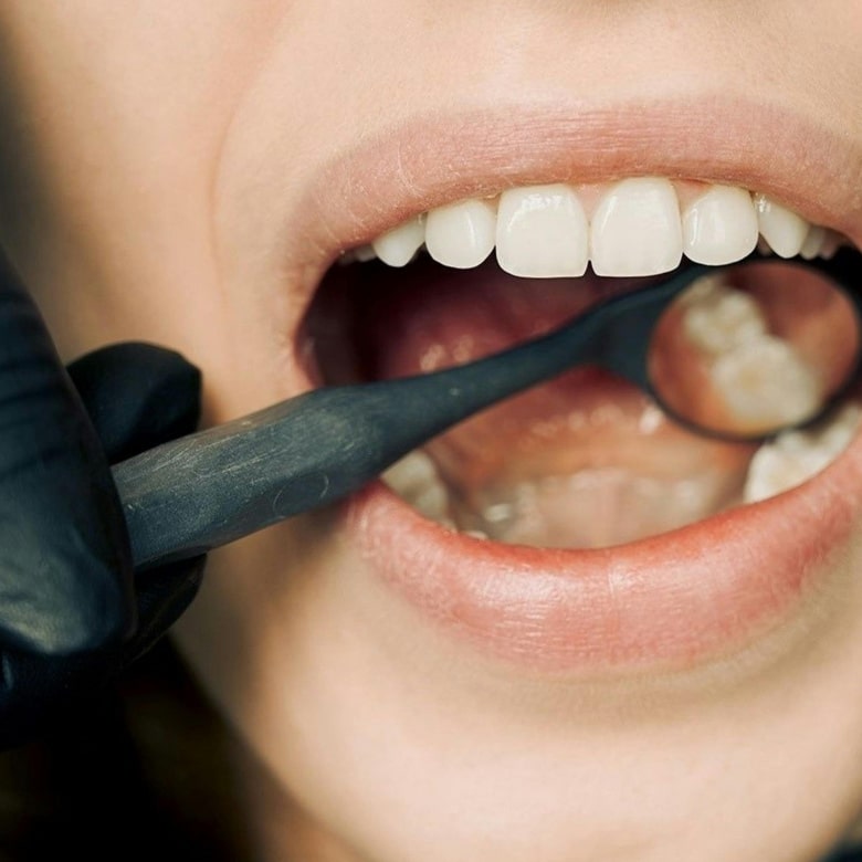 Dental checkup for implant need