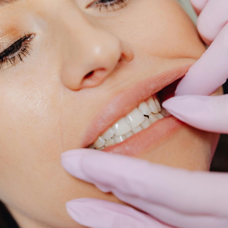 Dental implants checkup