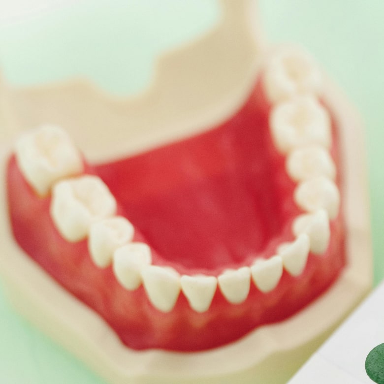 Example teeth with implant mold