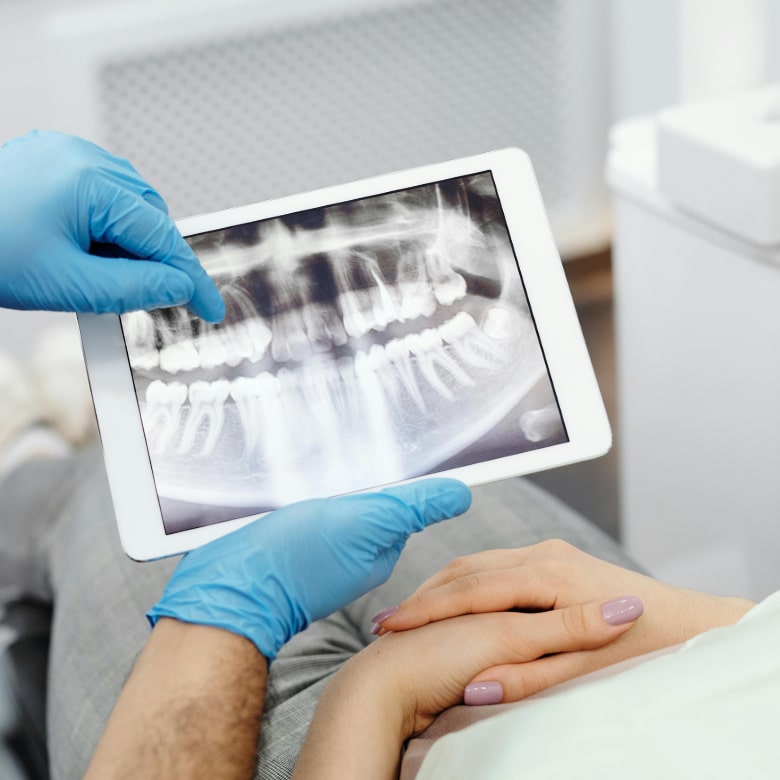 X-ray of missing teeth