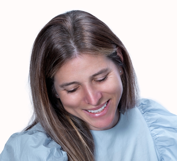 before-after-smile-gallery